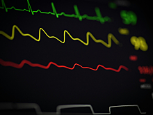 Сердце не билось 15 минут: многодетная мать из Кемерова вернулась с "того света"