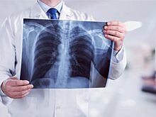 Правда ли, что МРТ и рентген опасны для здоровья