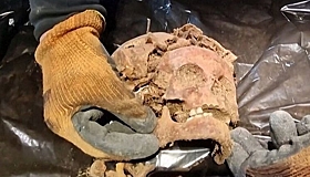 Под «Волчьим логовом» Гитлера нашли скелеты без стоп и кистей рук