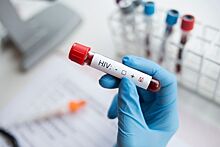 Открылся первый в мире банк спермы ВИЧ-инфицированных