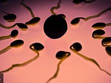 Простая математика поможет вылечить мужское бесплодие