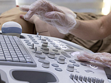 Четыре современных ультразвуковых сканера появились в больнице Когалыма