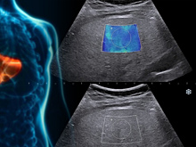 В России разработали оптический прибор для диагностики заболеваний печени