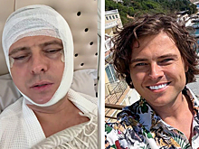 Страшно, всё лицо в синяках. Стало известно, кто отправил Прохора Шаляпина на больничную койку