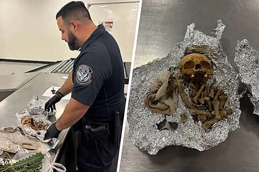 NYP: в аэропорту Флориды в багаже туриста нашли кости для проведения ритуалов