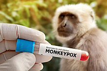 Почему эпидемия оспы обезьян пошла на спад до вакцинации