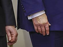 Трамп скрыл синяк перед встречей с Зеленским