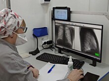 В 2024 году 68 маленьких жителей Новосибирской области переболели туберкулез