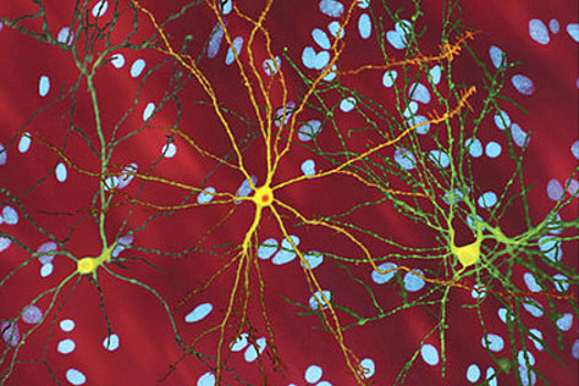 Найдено средство против смертельных болезней мозга
