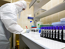Раскрыты результаты тестирования российской вакцины от коронавируса на ученых