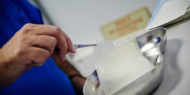 Столичные врачи спасли девочку с ожогами 55% тела и создали ей новое лицо