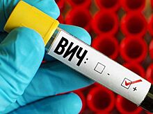 Что нужно знать о ВИЧ?