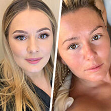 Без макияжа и фильтров: как по-настоящему выглядят российские звезды