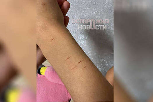 В Омске разыскивают мужчину, избившего и порезавшего 11-летнюю девочку