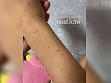 В Омске разыскивают мужчину, избившего и порезавшего 11-летнюю девочку