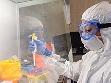 Еще 102 человека заболели коронавирусом на Кубани