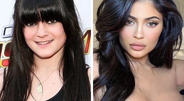 Фото знаменитостей до и после пластической операции