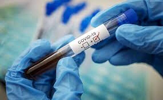 В Саратовской области за сутки коронавирусом заболели 124 человека