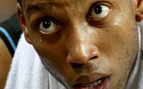 У баскетболиста "Нью-Зиланд Брейкерс" выпал глаз во время матча