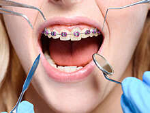 Можно ли «прирастить» обратно выбитый зуб у ребенка