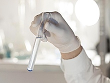 Российские ученые создали новый антибактериальный гидрогель