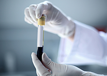Ученые создадут мини-устройство для моментального анализа крови