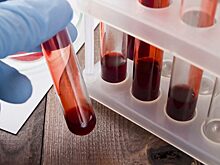 В США нашли лабораторию КНР с опасными вирусами