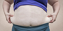 Российские диетологи доказали заразность ожирения