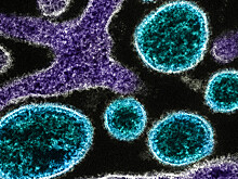 Уникальная разработка: российские ученые научились выявлять смертельный вирус Нипах